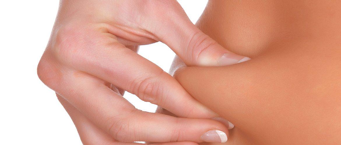 liposuction sheffield