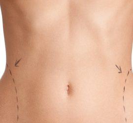 image tummy tuck abdominoplasty plastic surgery cosmetic surgery sheffield