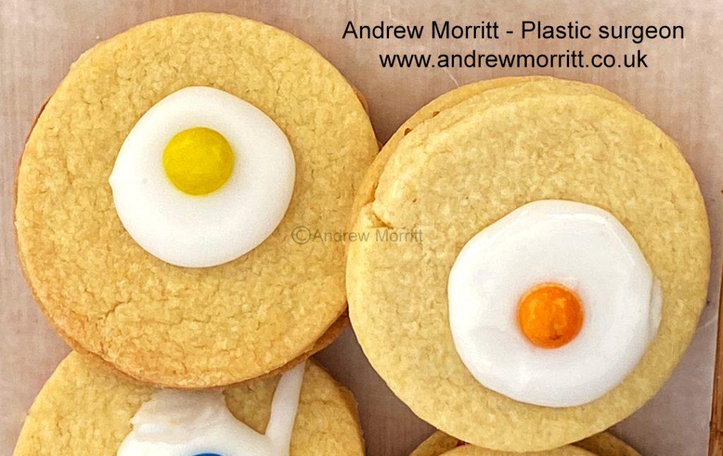 breast asymmetry correction sheffield