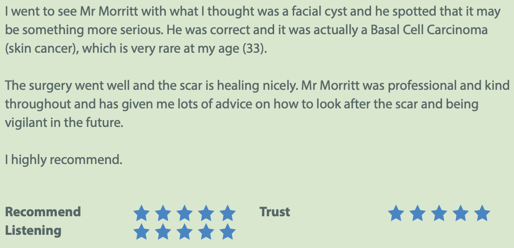 Review BCC (Basal cell carcinoma) treatment Sheffield