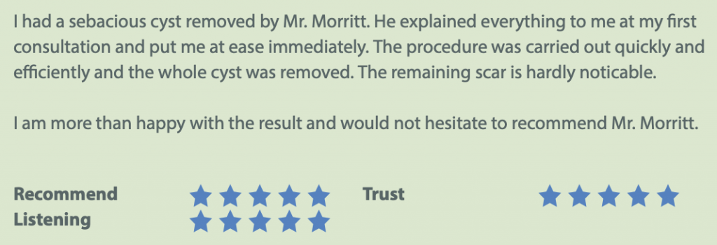sebaceous epidermoid cyst lump removal review sheffield