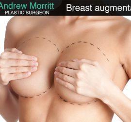 breast augmentation sheffield