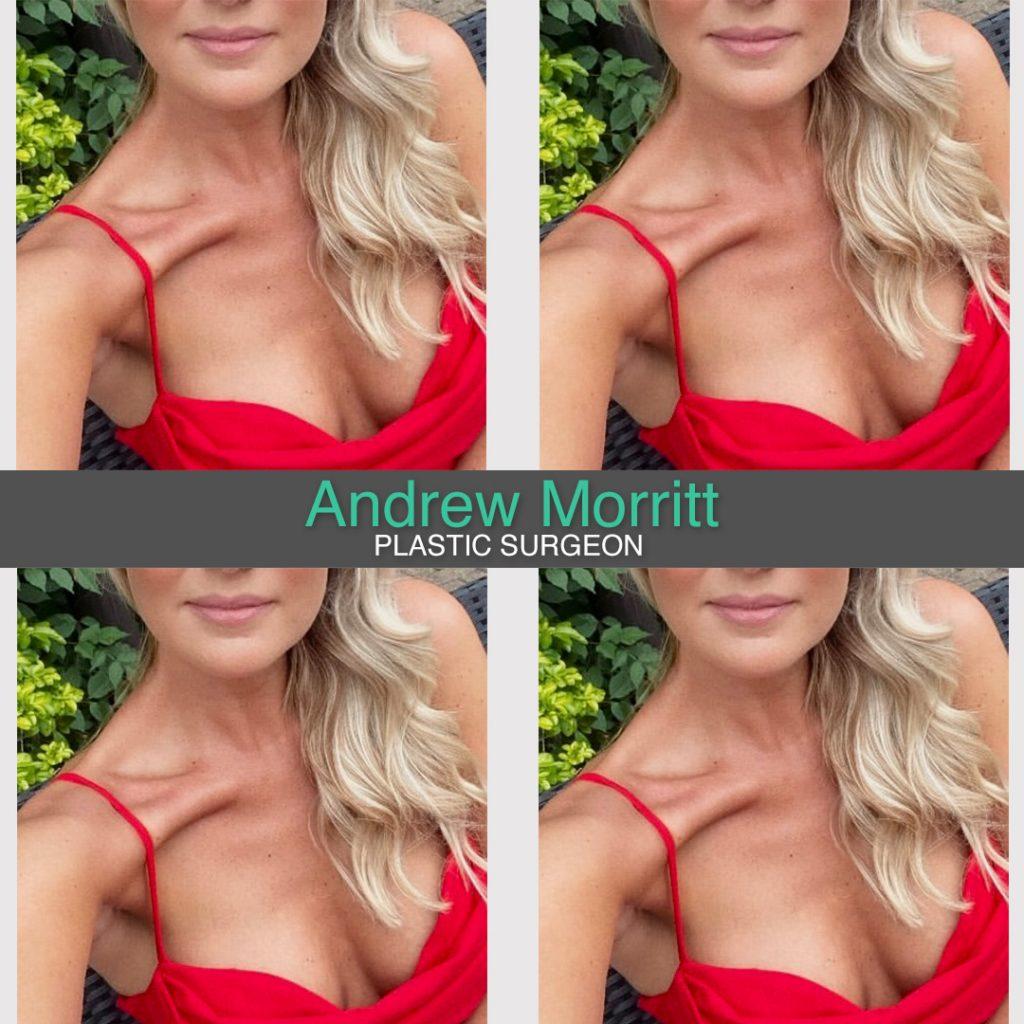 breast augmentation enlargement sheffield 18 breast augmentation enlargement sheffield