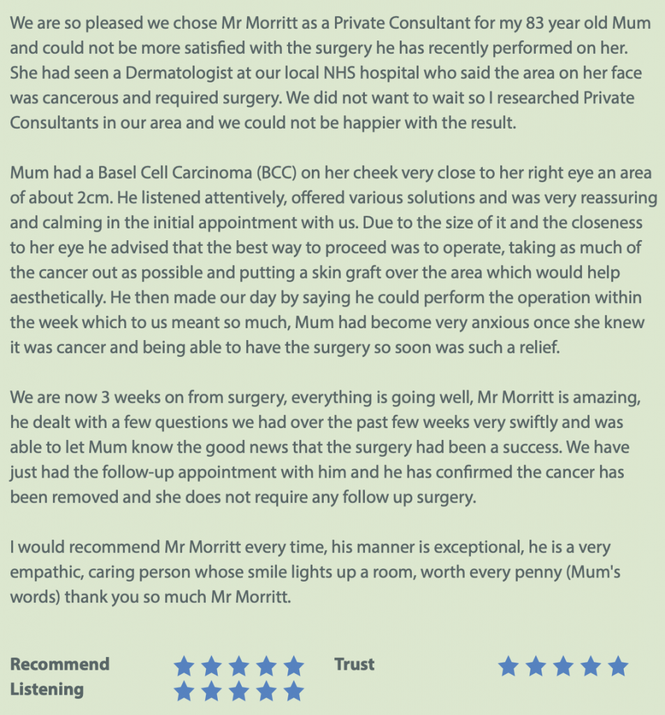 BCC removal review Sheffield