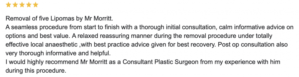 lipoma removal review